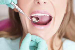 Recycling Dental Amalgam Couldn’t Be Easier